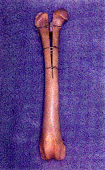 chd2.gif (23741 bytes)